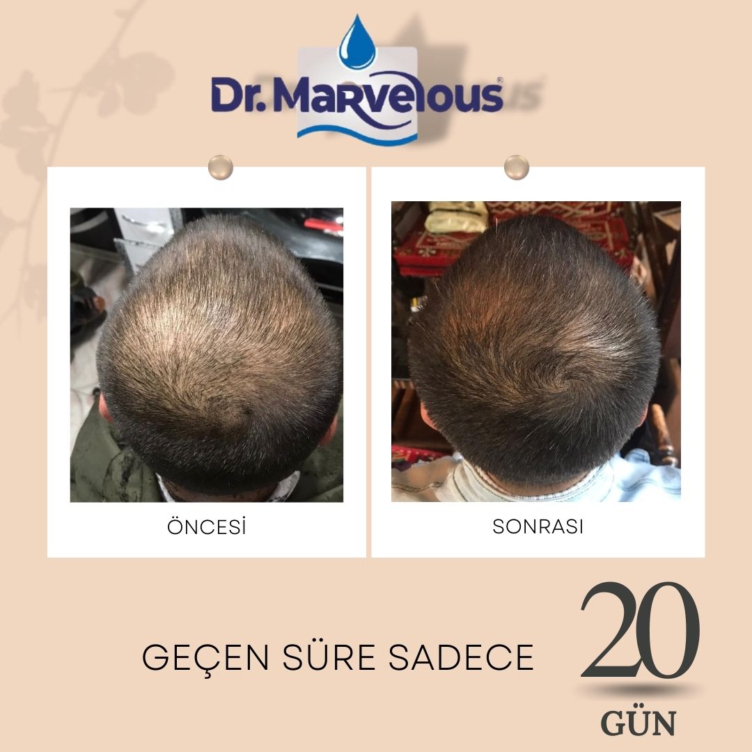 Doğal Saç Serumu 50ml